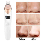 Electric Blackhead Remover Vacuum – Professional Pore Cleaner & Acne Needle Kit BuyMarto